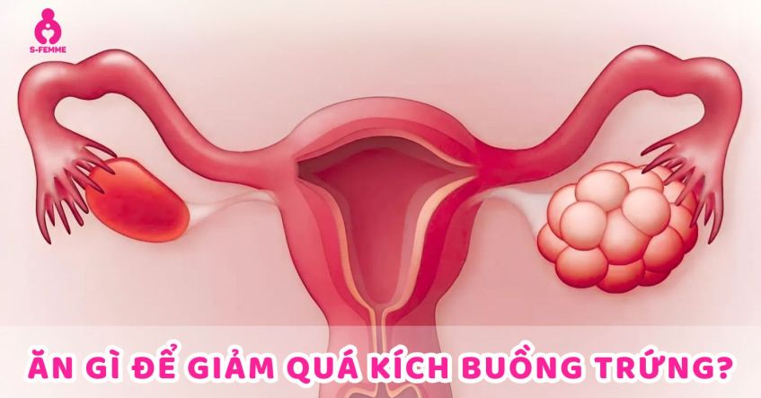 Ăn gì để giảm quá kích buồng trứng? Giải pháp từ chuyên gia