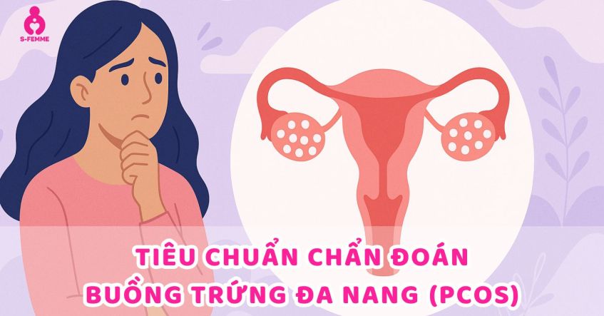 Tổng hợp tiêu chuẩn chẩn đoán buồng trứng đa nang​ (PCOS)