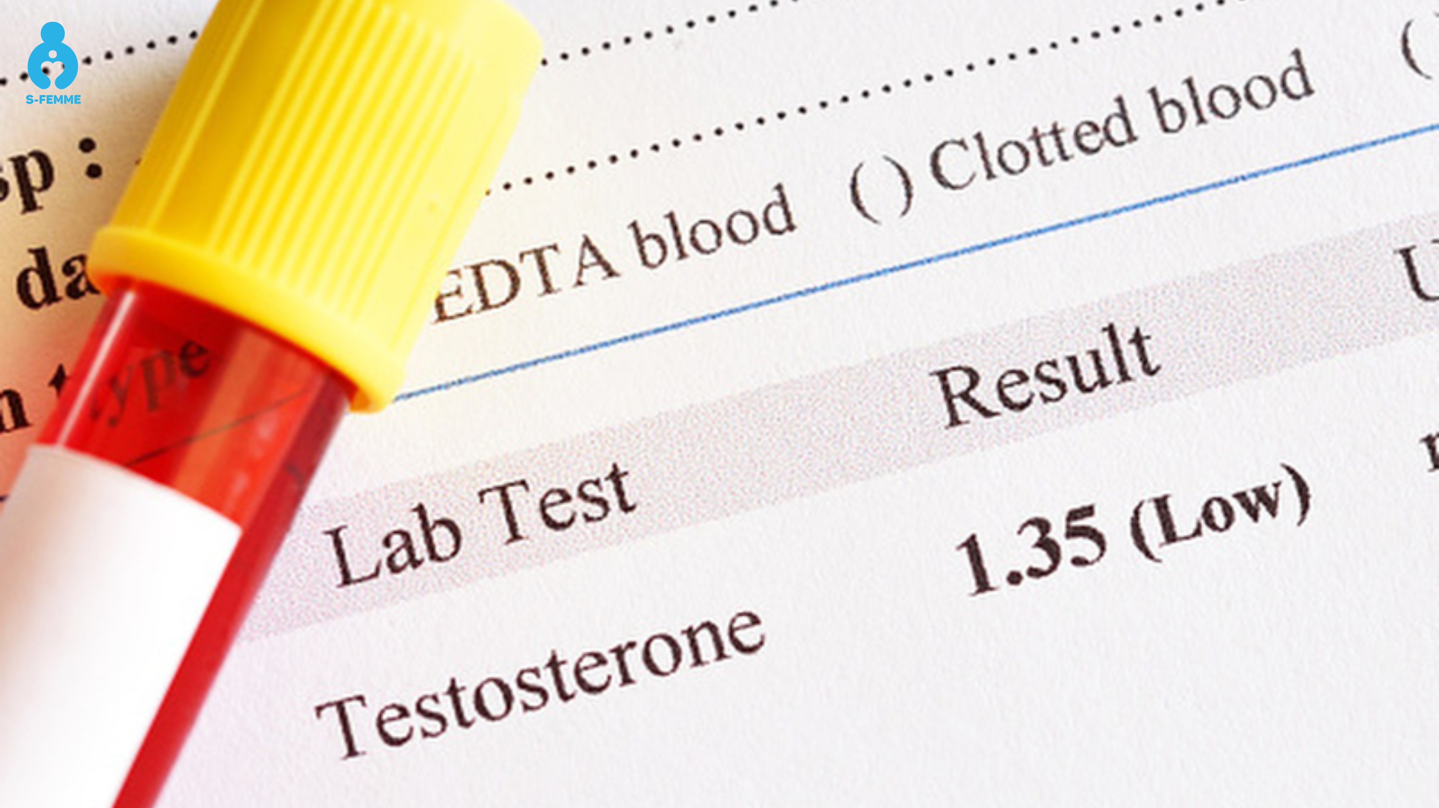 Nồng độ testosterone bình thường