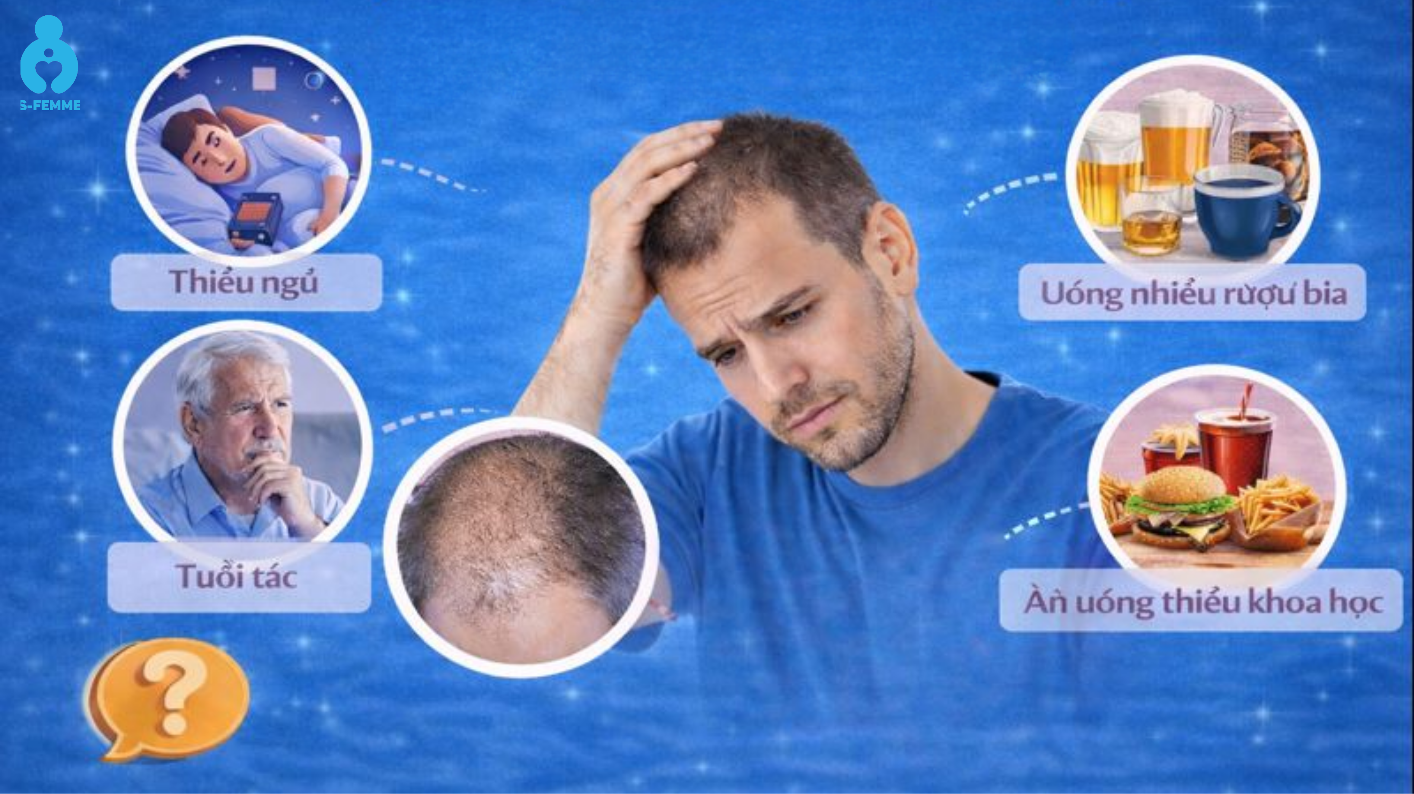 Những yếu tố làm testosterone suy giảm và khiến tóc rụng nhiều hơn