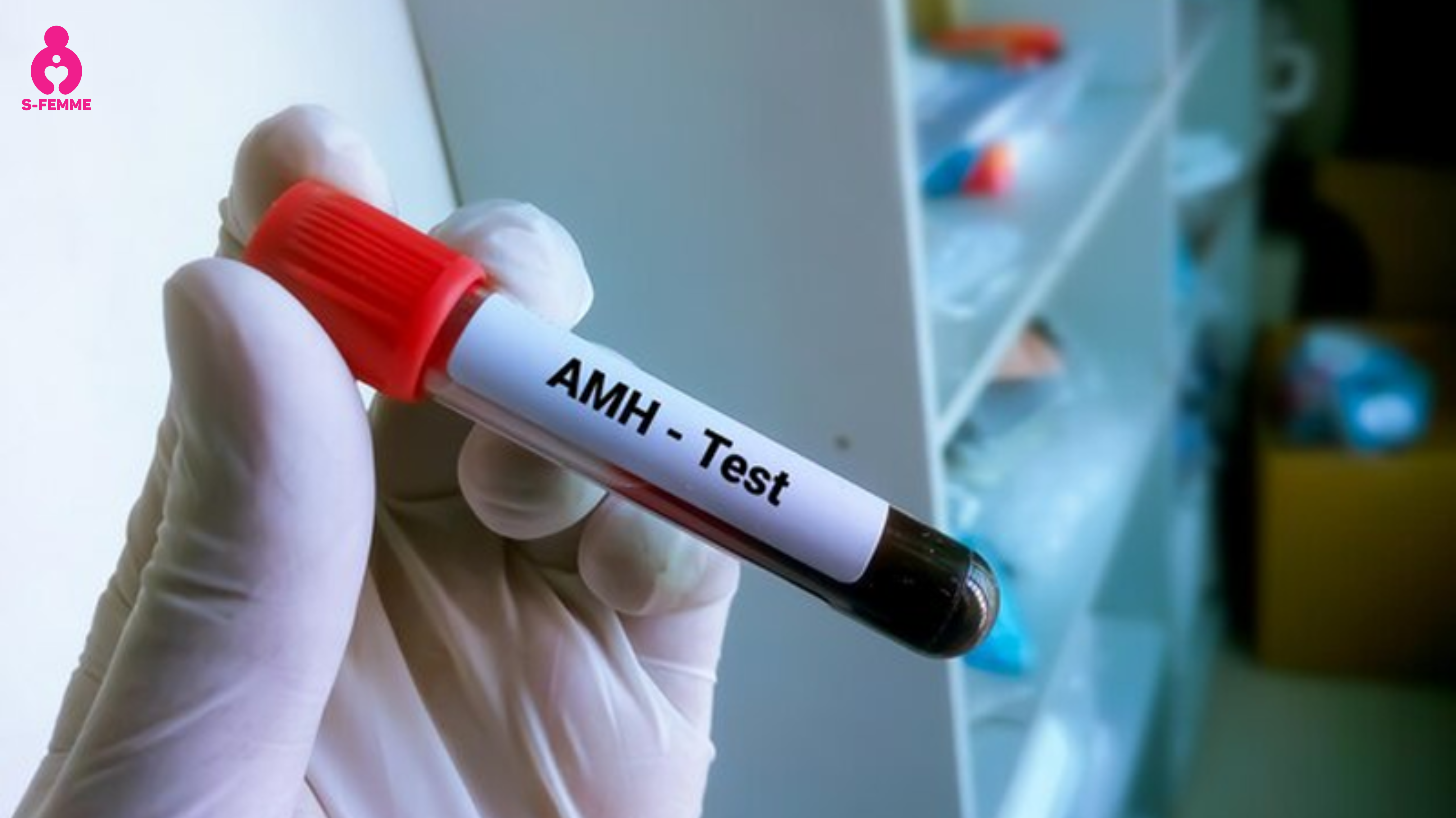 Xét nghiệm AMH là gì