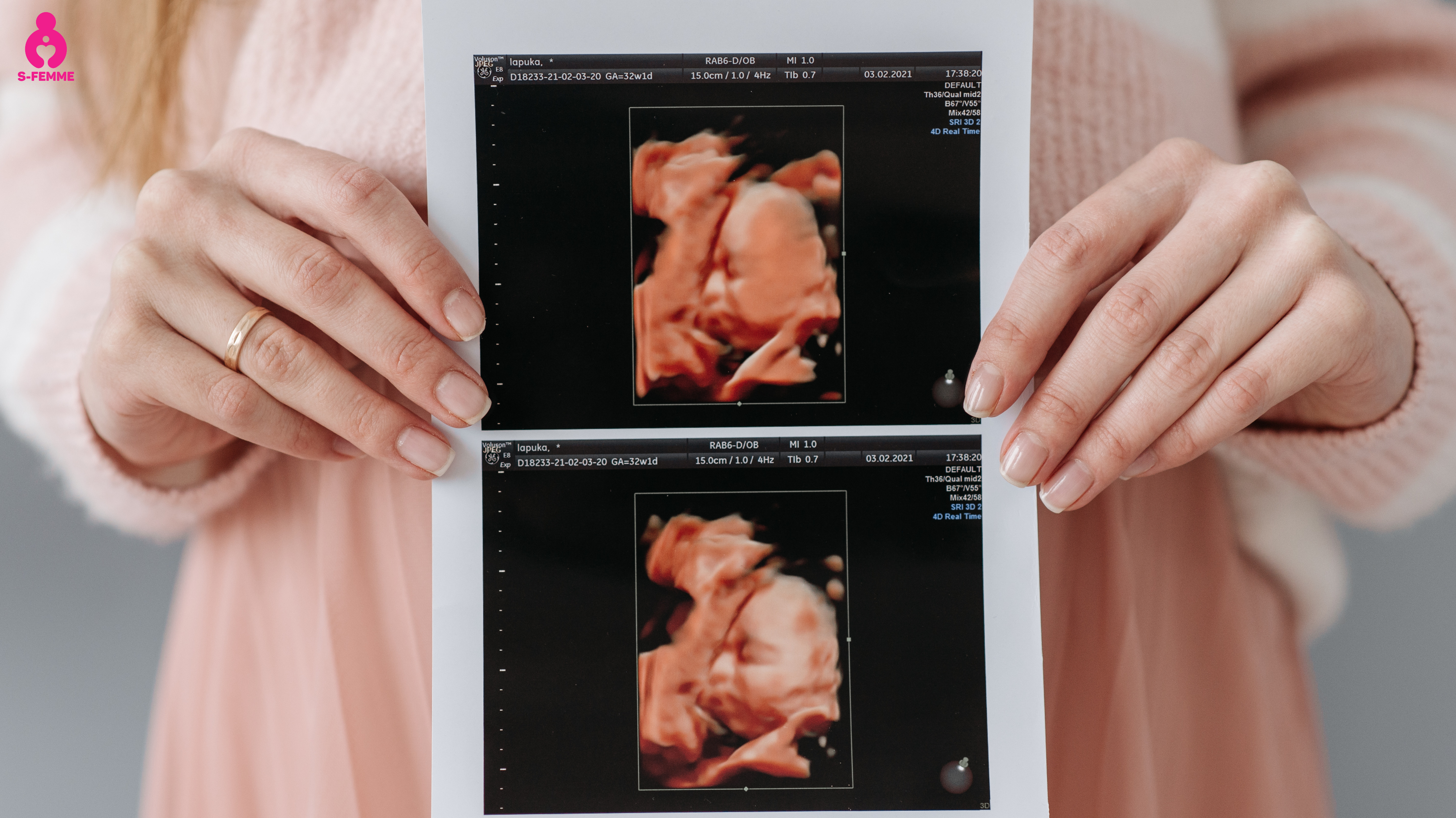 amh thấp có thể có thai