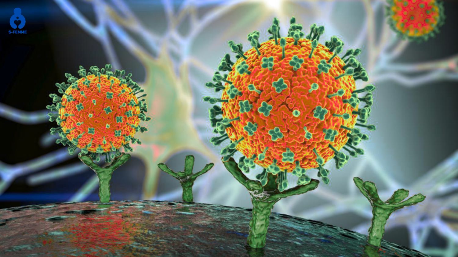 Nguyên nhân quai bị ở nam do virus thuộc nhóm paramyxo gây ra
