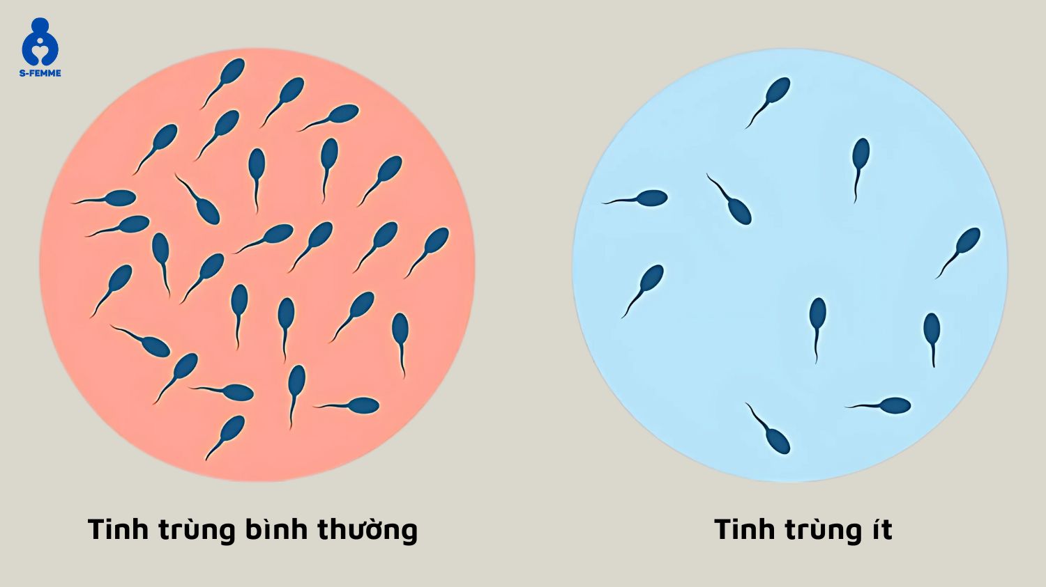Số lượng ảnh hưởng đến sức khỏe tinh trùng