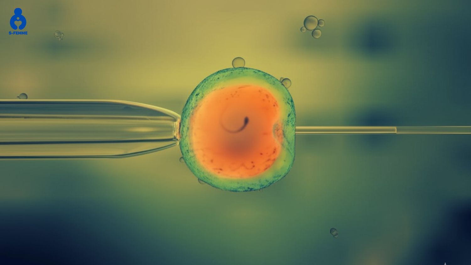 Thụ tinh trong ống nghiệm IVF hỗ trợ tình trạng hiếm muộn ở nam giới