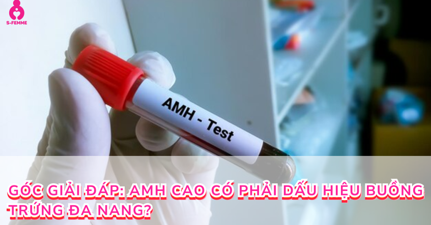 Góc giải đáp: Amh cao có phải dấu hiệu buồng trứng đa nang?