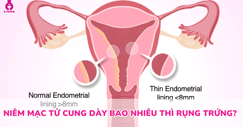 Niêm mạc tử cung dày bao nhiêu thì rụng trứng​? Hiểu đúng để tăng khả năng thụ thai tự nhiên