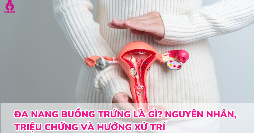 Đa nang buồng trứng là gì? Nguyên nhân, triệu chứng và hướng xử trí 