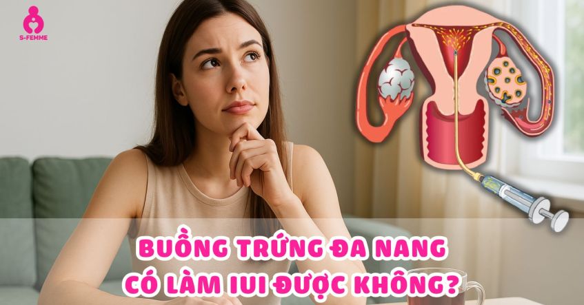 Giải đáp: Buồng trứng đa nang có làm IUI được không​?