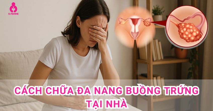 Cách chữa buồng trứng đa nang tại nhà dễ thực hiện