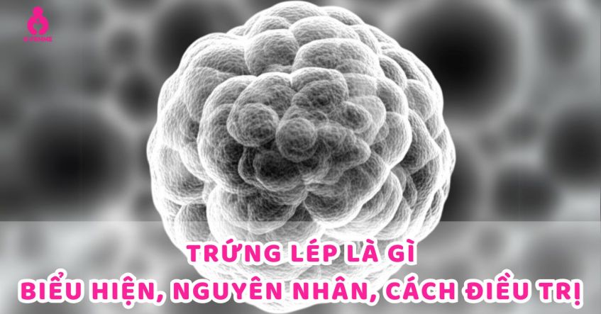 Trứng lép là gì? Biểu hiện, Nguyên nhân, Cách điều trị