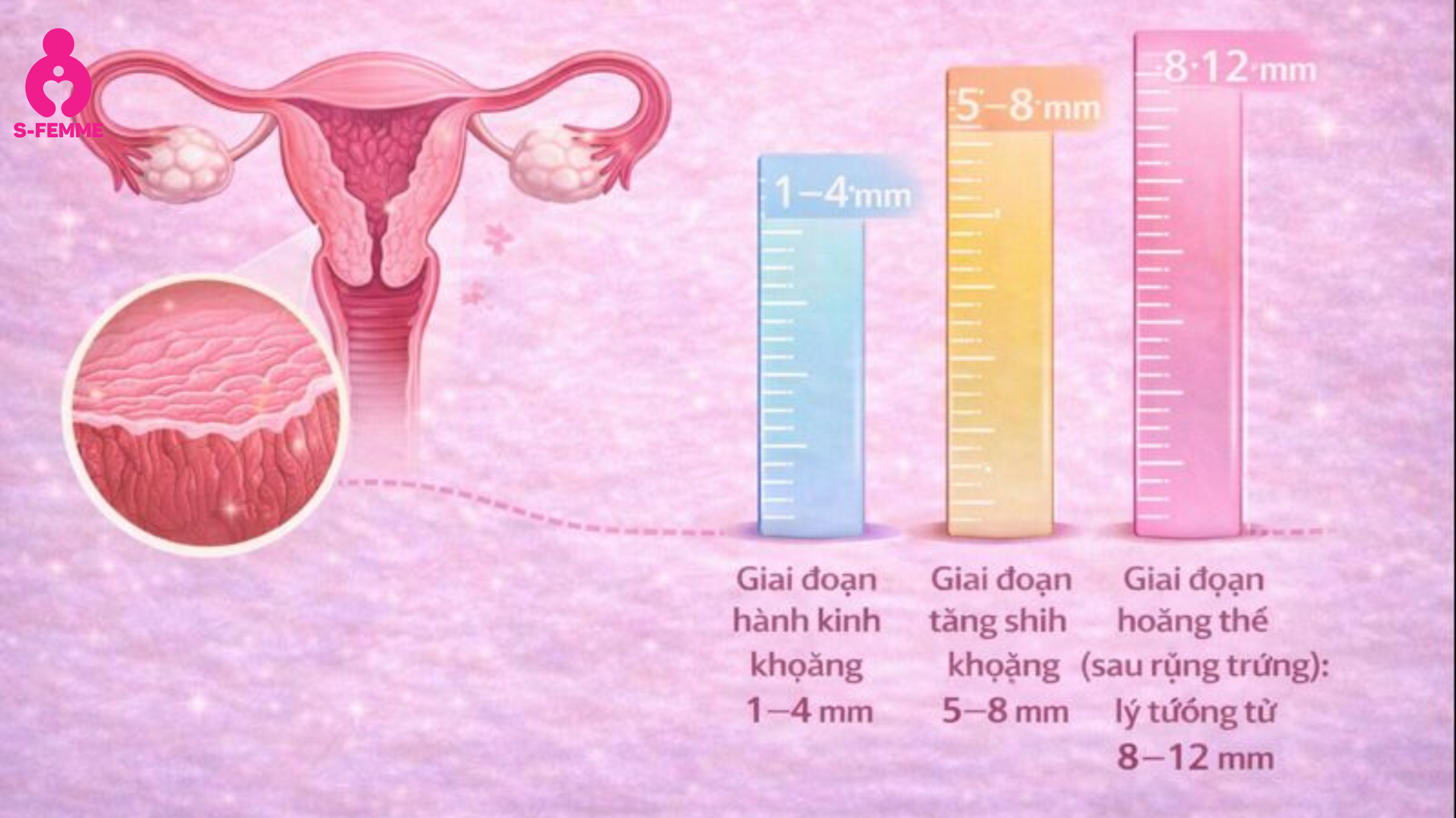 Niêm mạc tử cung dày bao nhiêu được xem là lý tưởng