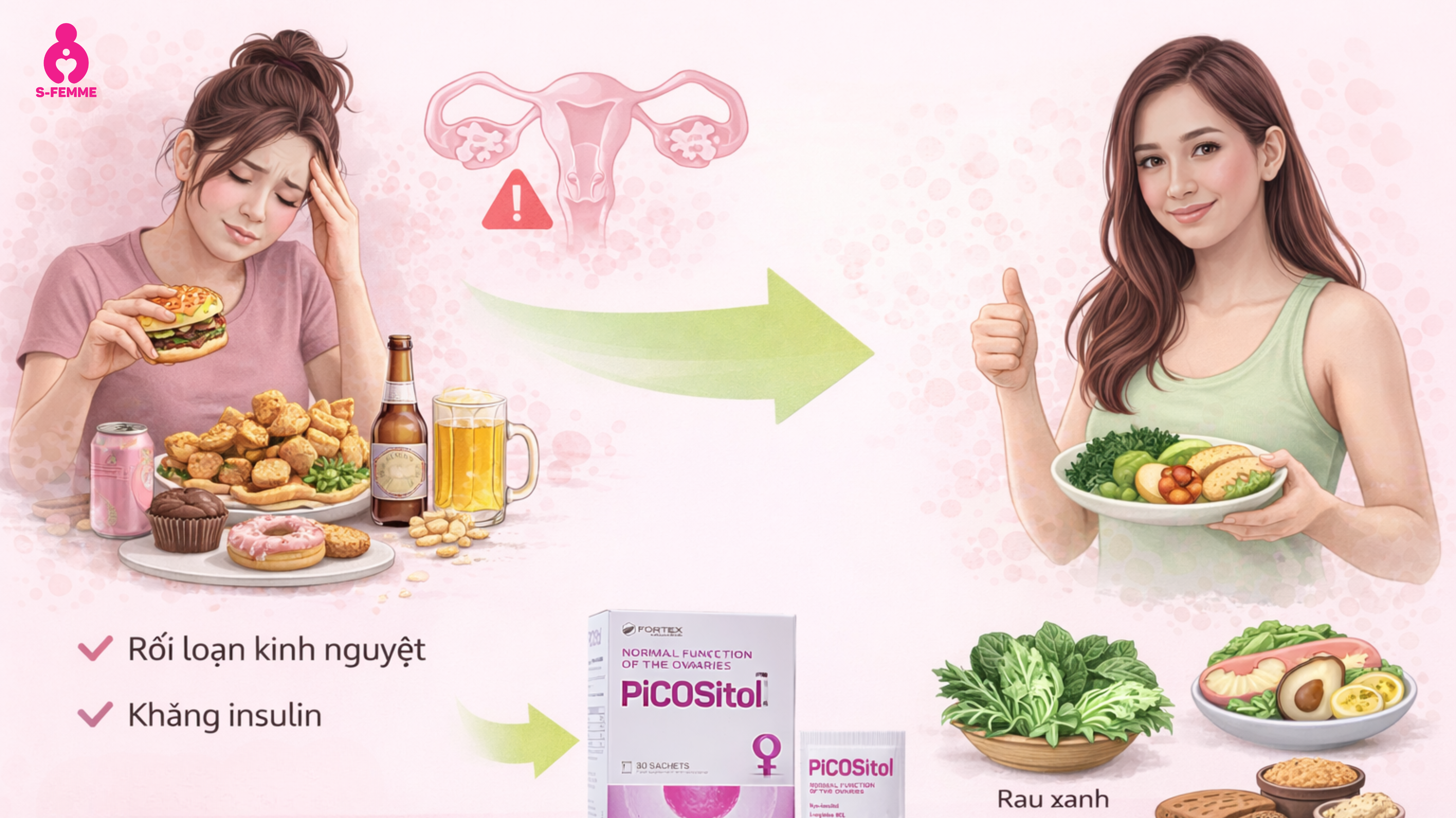 a nang buồng trứng và vai trò của chế độ ăn uống